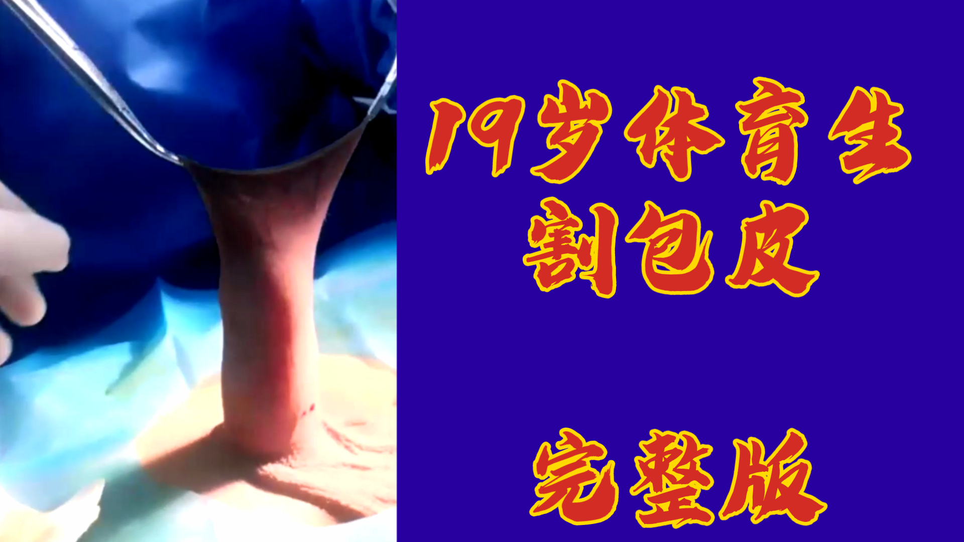 19岁体育生割包皮，完整版